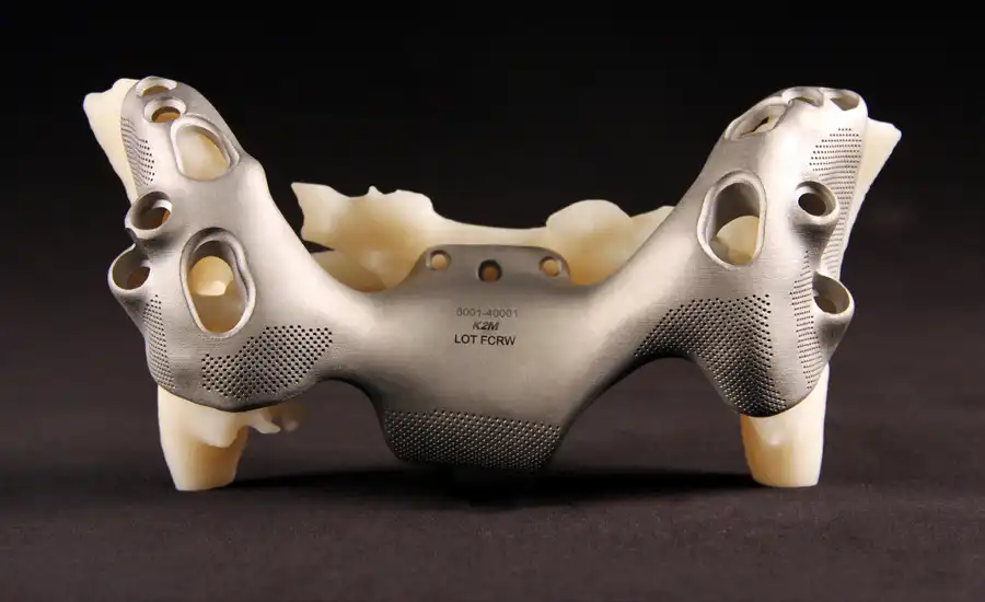 Demystifying SLS: How Selective Laser Sintering Unlocks Unique 3D Printing Capabilities Ergonomic Tools