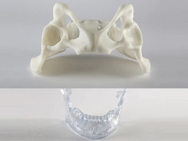 Demystifying SLS: How Selective Laser Sintering Unlocks Unique 3D Printing Capabilities 3D printing medical 3D printed surgical g