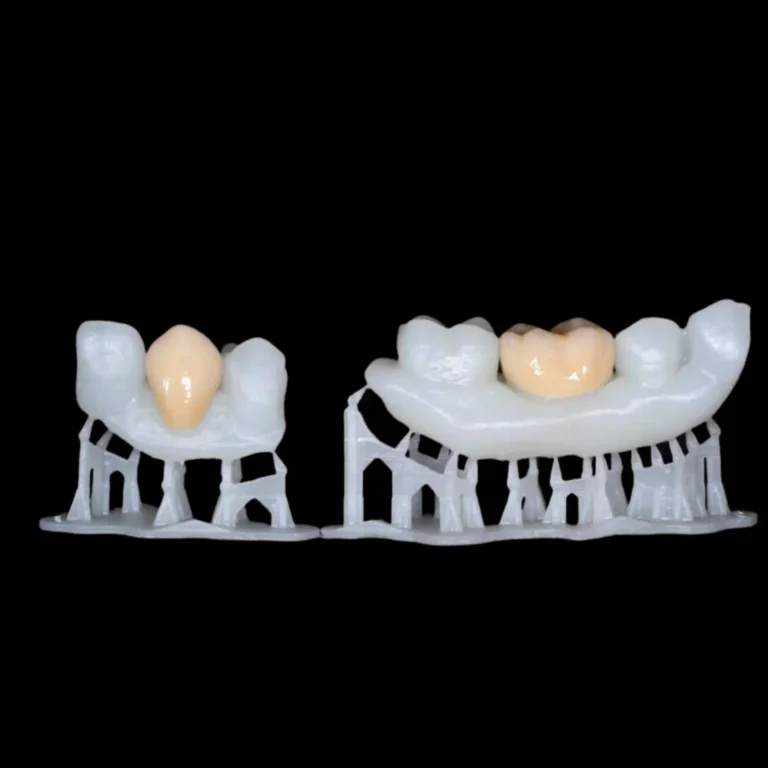 Temporary Crown