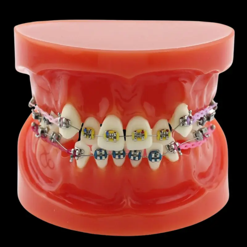 DLP 3D Printing for Dental Orthodontic Models