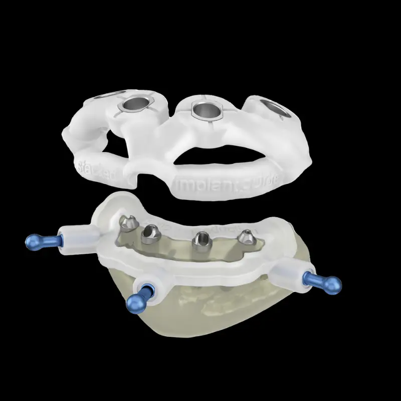 DLP 3D Printing for Dental Surgical Guides