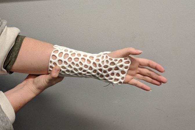 sla for orthotics